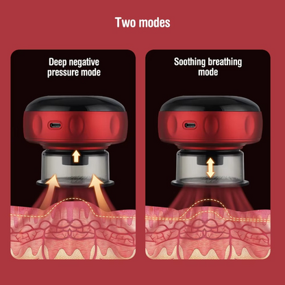 Intelligent Vacuum Cupping Therapy Set